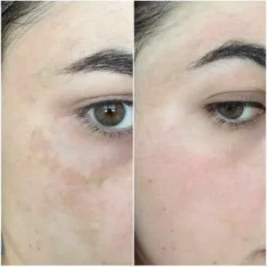 کرم ضد لک سیستئامین سیسپرسا