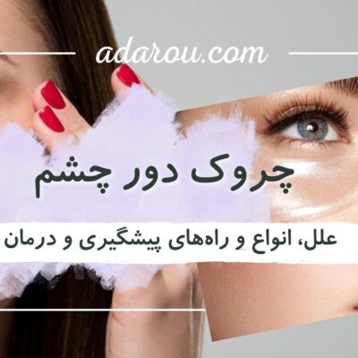 پیشگیری و درمان چروک دور چشم