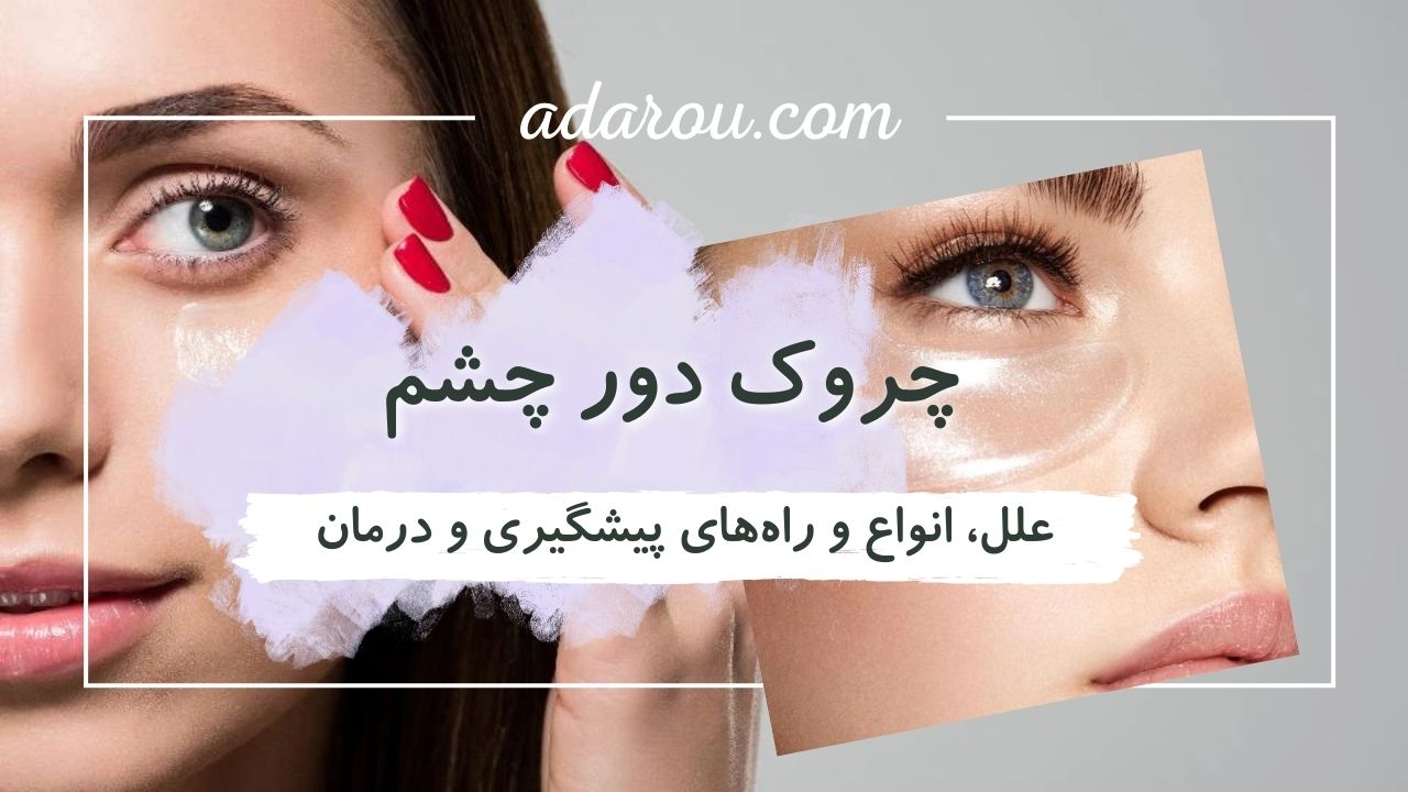 پیشگیری و درمان چروک دور چشم