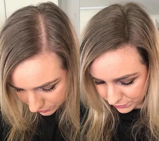 ماسک مو مناسب موی نازک و کم حجم سریتا بیوتی